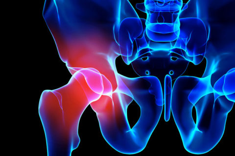 What causes hip pain